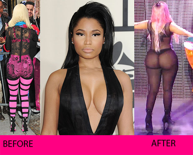 Nicki Minaj Cfake